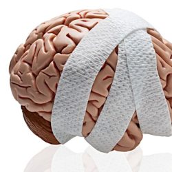 Hesi case studies traumatic brain injury