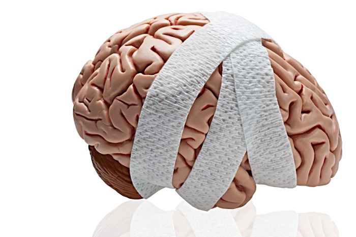 Hesi case studies traumatic brain injury