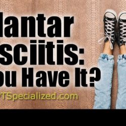 Do i have plantar fasciitis quiz