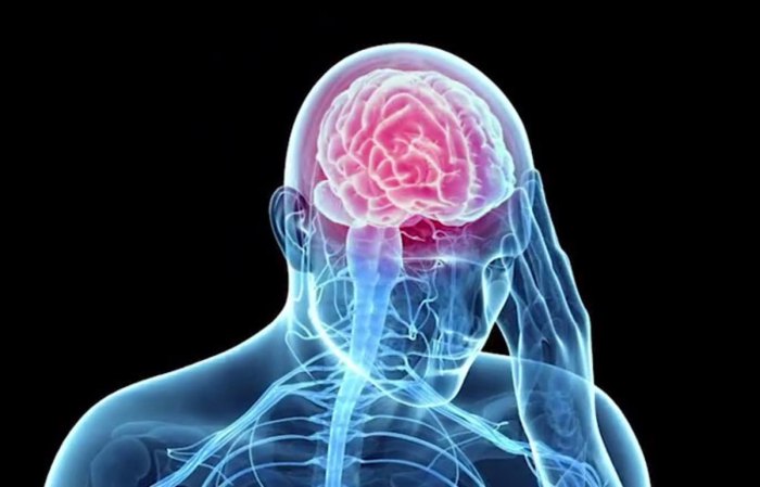 Hesi case studies traumatic brain injury